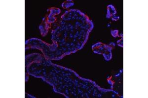 IF analysis of ALPP using anti-ALPP antibody (ABIN4886453). (PLAP antibody  (C-Term))