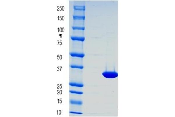 Pyrophosphatase (Inorganic) 1 (PPA1) protein (His tag)