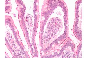 Human Small Intestine: Formalin-Fixed, Paraffin-Embedded (FFPE) (LTB4R2 antibody  (N-Term))