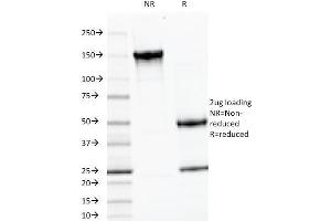 SDS-PAGE Analysis Purified LH-beta Mouse Monoclonal Antibody (LHb/1214). (LHB antibody)