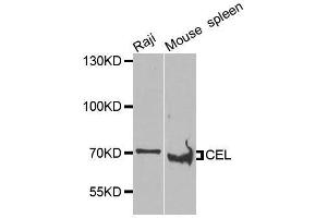 Western blot analysis of extracts of various cell lines, using CEL antibody. (Cholesterol Esterase antibody)