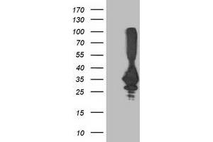 HEK293T cells were transfected with the pCMV6-ENTRY control (Left lane) or pCMV6-ENTRY PNMT (Right lane) cDNA for 48 hrs and lysed. (PNMT antibody)