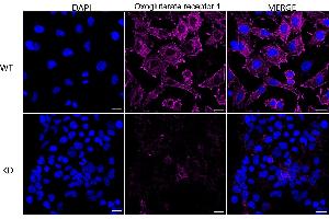 Immunocytochemical staining of HeLa cells using Oxoglutarate receptor 1 antibody (ABIN7799714), 1:1,000), Top panel: wild-type (WT), Bottom panal: Oxoglutarate receptor 1 shRNA knockdown (KD). (Recombinant OXGR1 antibody)