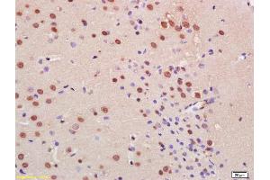 Formalin-fixed and paraffin embedded rat brain with labeled Anti-C9orf72 Polyclonal Antibody, Unconjugated (ABIN1386141) at 1:200, followed by conjugation to the secondary antibody and DAB staining (C9ORF72 antibody  (AA 391-481))