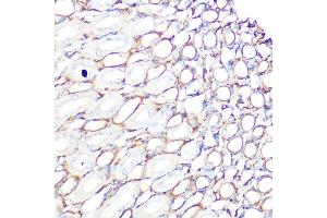 Immunohistochemistry of paraffin-embedded mouse kidney using Filamin A Rabbit mAb (ABIN1682545, ABIN3018024, ABIN3018025 and ABIN7101570) at dilution of 1:100 (40x lens). (Filamin A antibody)