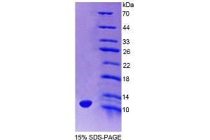 SDS-PAGE (SDS) image for HOP Homeobox (HOPX) (AA 11-73) protein (His tag) (ABIN6238691) (HOPX Protein (AA 11-73) (His tag))