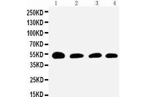Anti-Antithrombin III antibody, Western blotting Lane 1: Rat Testis Tissue Lysate Lane 2: SMMC Cell Lysate Lane 3: JURKAT Cell Lysate Lane 4: RAJI Cell Lysate (SERPINC1 antibody  (N-Term))