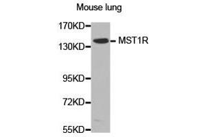 Western Blotting (WB) image for anti-Macrophage Stimulating 1 Receptor (C-Met-Related tyrosine Kinase) (MST1R) antibody (ABIN2650934) (MST1R antibody)