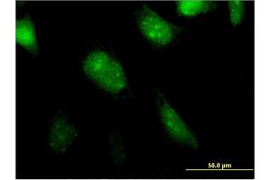 Immunofluorescence of monoclonal antibody to BATF2 on HeLa cell. (BATF2 antibody  (AA 1-189))
