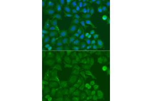 Immunofluorescence analysis of A549 cell using SSX5 antibody. (SSX5 antibody)