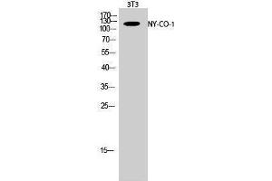 Western Blotting (WB) image for anti-serologically Defined Colon Cancer Antigen 1 (SDCCAG1) (C-Term) antibody (ABIN3185981) (NEMF antibody  (C-Term))