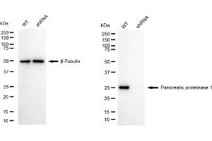 Western blotting analysis using pancreatic proteinase 1 antibody (ABIN7799732). (Recombinant Pancreatic Proteinase 1 (PRT1) antibody)