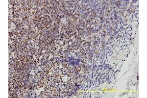 Immunoperoxidase of monoclonal antibody to PHB on formalin-fixed paraffin-embedded human tonsil tissue. (Prohibitin antibody  (AA 1-272))