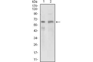 Western blot analysis using GPNMB antibody against PANC1 (1) and PC-3 (2) cell lysate. (Osteoactivin antibody  (AA 31-260))