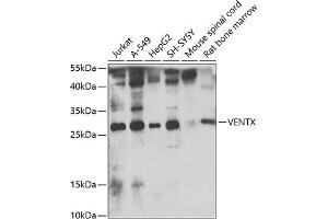 Western blot analysis of extracts of various cell lines, using VENTX antibody  at 1:1000 dilution. (VENTX antibody  (AA 1-258))
