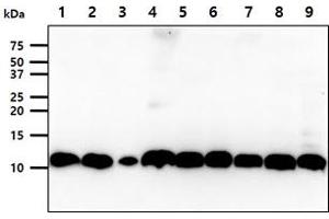 The cell lysates (40ug) were resolved by SDS-PAGE, transferred to PVDF membrane and probed with anti-human S100A11 antibody (1:1000).