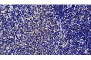 Detection of MAP2K4 in Rat Spleen Tissue using Polyclonal Antibody to Mitogen Activated Protein Kinase Kinase 4 (MAP2K4) (MAP2K4 antibody  (AA 137-394))