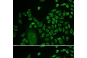 Immunofluorescence analysis of HeLa cells using LSM4 Polyclonal Antibody at dilution of 1:50. (LSM4 antibody)