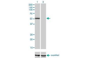 Western blot analysis of BFAR over-expressed 293 cell line, cotransfected with BFAR Validated Chimera RNAi (Lane 2) or non-transfected control (Lane 1). (BFAR antibody  (AA 101-200))