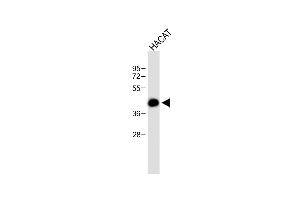 Anti-RCO Antibody (N-term) at 1:500 dilution + HACAT whole cell lysate Lysates/proteins at 20 μg per lane. (MARCO antibody  (AA 13-40))