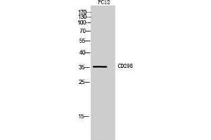 Western Blotting (WB) image for anti-ATPase, Na+/K+ Transporting, beta 3 Polypeptide (ATP1B3) (Internal Region) antibody (ABIN3181462) (ATP1B3 antibody  (Internal Region))