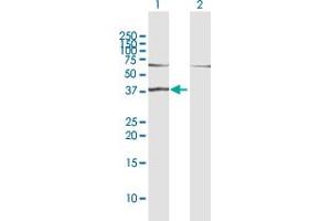 Western Blot analysis of RAD51L1 expression in transfected 293T cell line by RAD51L1 MaxPab polyclonal antibody. (RAD51 Homolog B antibody  (AA 1-384))