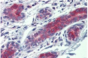 Human Breast: Formalin-Fixed, Paraffin-Embedded (FFPE) (YES1 antibody  (AA 284-541))