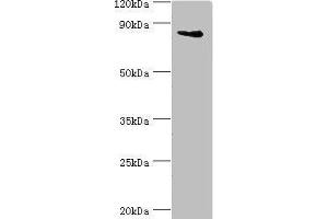 Western blot All lanes: Interleukin enhancer-binding factor 3 antibody at 3 μg/mL + HepG2 whole cell lysate Secondary Goat polyclonal to rabbit IgG at 1/10000 dilution Predicted band size: 96, 77, 83, 76, 75 kDa Observed band size: 96 kDa (Interleukin enhancer-binding factor 3 (ILF3) (AA 785-894) antibody)