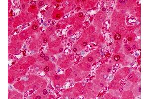 Human Liver: Formalin-Fixed, Paraffin-Embedded (FFPE) (ALDH5A1 antibody  (AA 128-157))