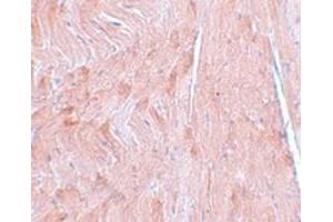 Immunohistochemical staining of mouse heart tissue with REEP3 polyclonal antibody  at 5 ug/mL dilution.