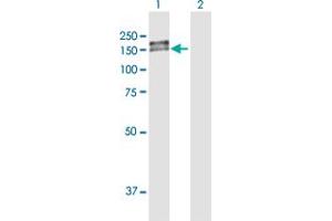 Western Blot analysis of PDGFRB expression in transfected 293T cell line by PDGFRB MaxPab polyclonal antibody. (PDGFRB antibody  (AA 1-1106))