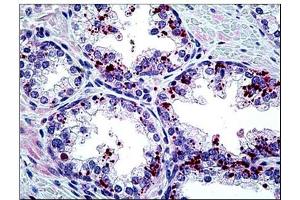Human Prostate: Formalin-Fixed, Paraffin-Embedded (FFPE) (ARTN antibody  (Internal Region))