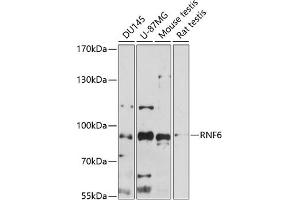 Western blot analysis of extracts of various cell lines, using RNF6 antibody (ABIN7270075) at 1:1000 dilution. (RNF6 antibody  (AA 1-300))