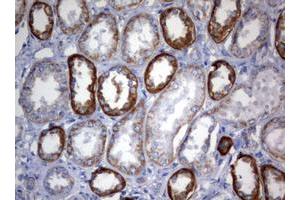 Image no. 2 for anti-3-Oxoacyl-ACP Synthase, Mitochondrial (OXSM) (AA 78-343) antibody (ABIN1491674) (OXSM antibody  (AA 78-343))