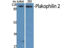 Western Blot (WB) analysis of Jurkat and 293 cells using Plakophilin 2 Polyclonal Antibody.