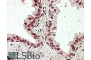 ABIN570834 (3. (Homeobox D13 antibody  (Internal Region))