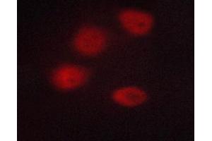 ABIN6267233 staining A549 cells by ICC/IF. (HDAC3 antibody  (pSer424))