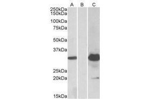 HEK293 lysate (10 µg protein in RIPA buffer) overexpressing Human KCTD11 with DYKDDDDK tag probed with AP23752PU-N (1. (KCTD11 antibody  (Internal Region))