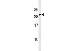 Western Blotting (WB) image for anti-Erythropoietin (EPO) (AA 155-184) antibody (ABIN3030869)