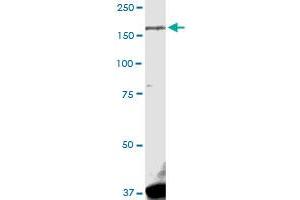 LRRK1 MaxPab rabbit polyclonal antibody. (LRRK1 antibody  (AA 1-261))