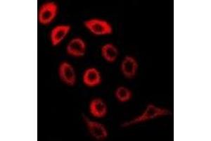 Immunofluorescent analysis of PDE1B staining in MCF7 cells. (PDE1B antibody)