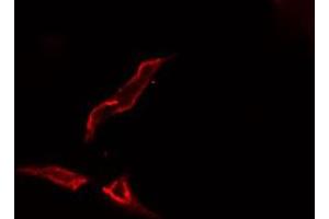 ABIN6276650 staining  Hela cells by IF/ICC. (TYR antibody  (C-Term))
