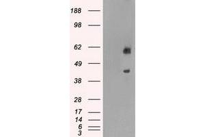 HEK293T cells were transfected with the pCMV6-ENTRY control (Left lane) or pCMV6-ENTRY PPP1R7 (Right lane) cDNA for 48 hrs and lysed. (PPP1R7 antibody)