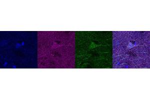 Immunohistochemistry (IHC) image for anti-Ubiquitin Carboxyl-terminal Esterase L1 (Ubiquitin Thiolesterase) (UCHL1) antibody (ABIN7456137) (UCHL1 antibody)