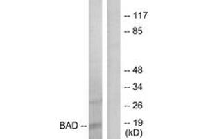 Western blot analysis of extracts from 293 cells, treated with Forskolin, using BAD (Ab-136) Antibody. (BAD antibody  (AA 102-151))
