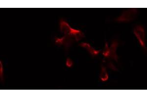 ABIN6274882 staining COLO205 by IF/ICC. (ABCB10 antibody  (Internal Region))