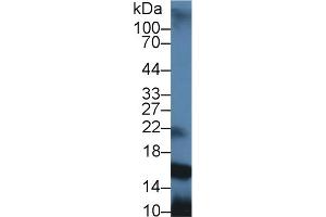 Detection of PIP in Rat Parotid Gland lysate using Polyclonal Antibody to Prolactin Induced Protein (PIP) (PIP antibody  (AA 41-139))