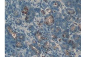 Immunohistochemistry (IHC) image for anti-Hypoxia Inducible Factor 1, alpha Subunit (Basic Helix-Loop-Helix Transcription Factor) (HIF1A) (AA 641-810) antibody (ABIN1859154)