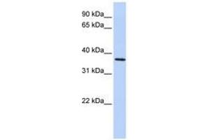Image no. 1 for anti-F-Box Protein 8 (FBXO8) (AA 216-265) antibody (ABIN6741269) (FBXO8 antibody  (AA 216-265))