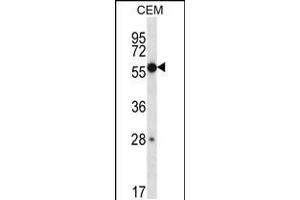 Western blot analysis in CEM cell line lysates (35ug/lane). (ZNF764 antibody  (AA 84-113))